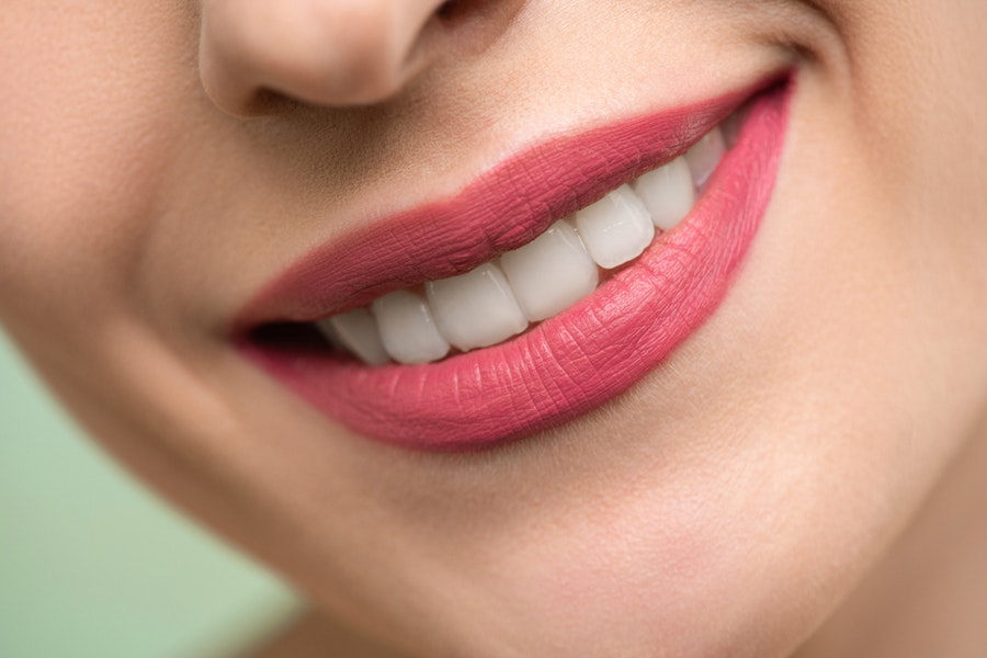 Essential Considerations to Keep your Teeth Healthy