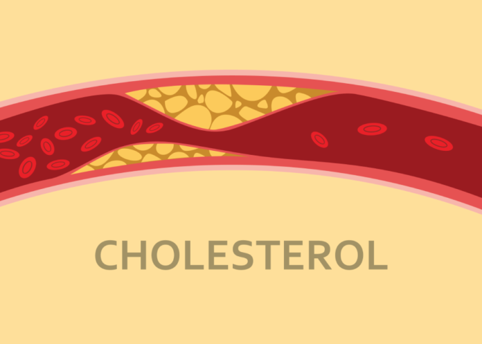 Should you be worried about your Cholesterol Levels